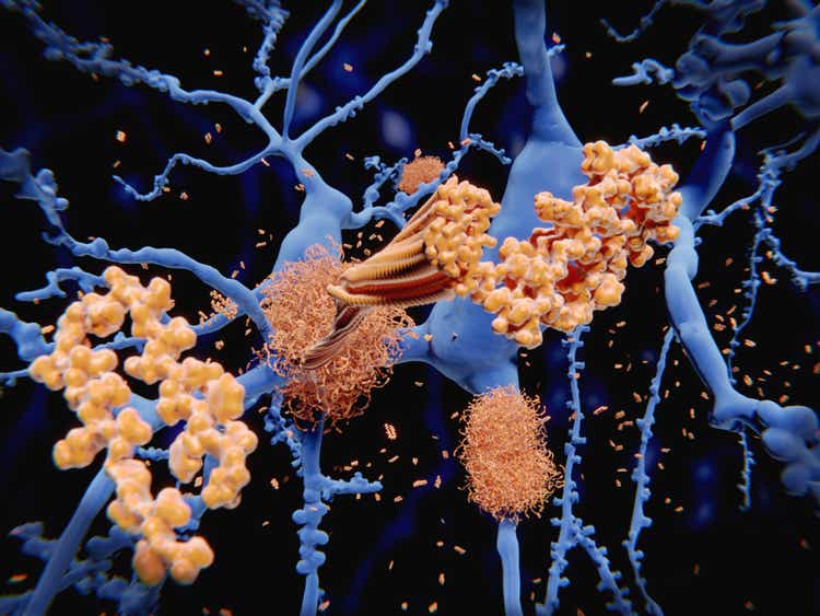 Alzheimer"s disease: the amyloid-beta peptide accumulates to amyloid fibrils that build up dense amyloid plaques.