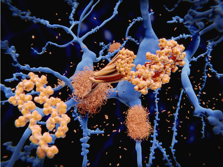 Biogen Ahead of Key FDA Decision Amid Mixed Opinions on Possible Alzheimer’s Therapy