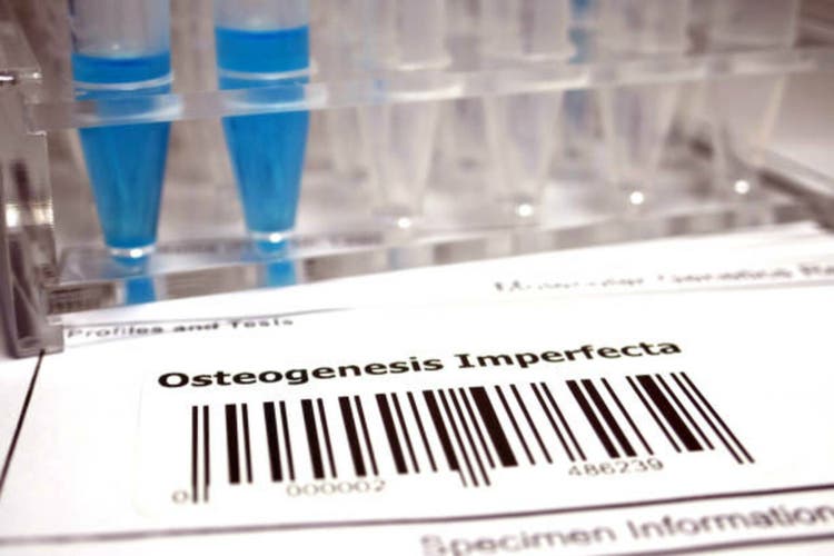 Ultragenyx, Mereo in selloff after trial update on bone disorder therapy