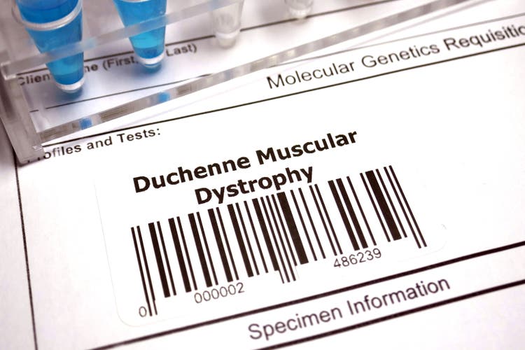 Duchenne muscular dystrophy