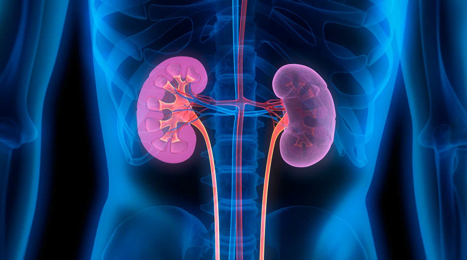 Eledon Pharmaceuticals: Disrupting The Kidney Transplantation Landscape ...