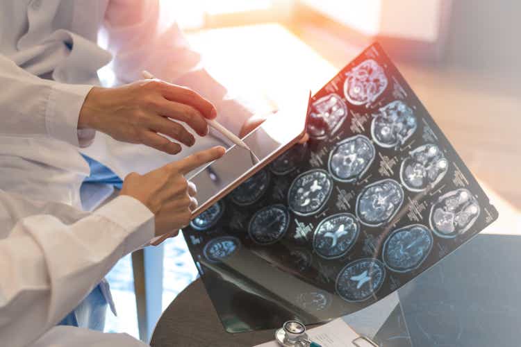 MRI digital x-ray of brain with team radiologist doctor oncology working together in clinic hospital. Medical healthcare concept.