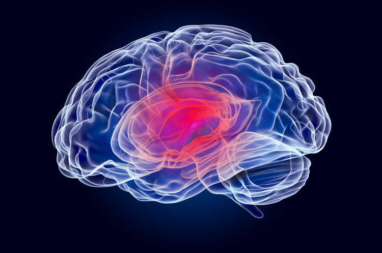 Brain disease concept, x-ray hologram. 3D rendering