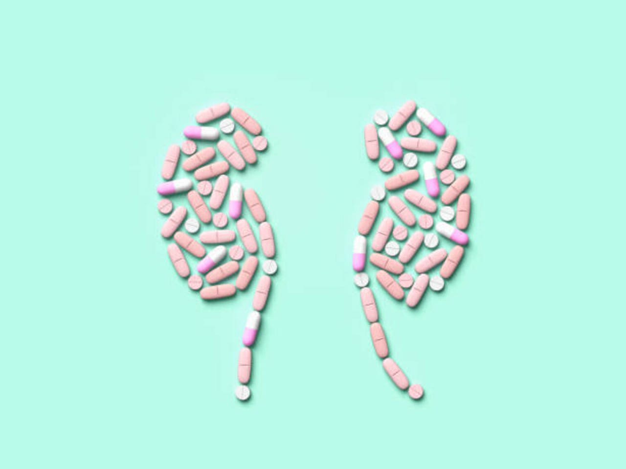 Travere Therapeutics: Still Undervalued Post FSGS Approval