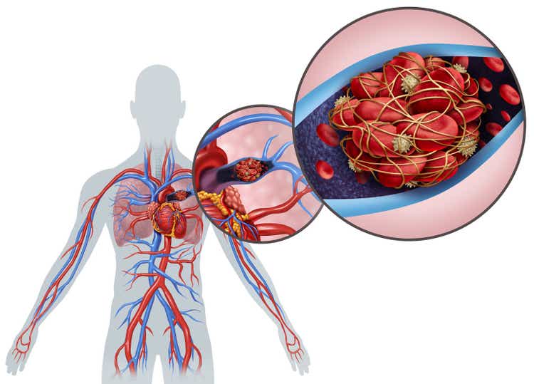 Pulmonary Embolism Anatomy