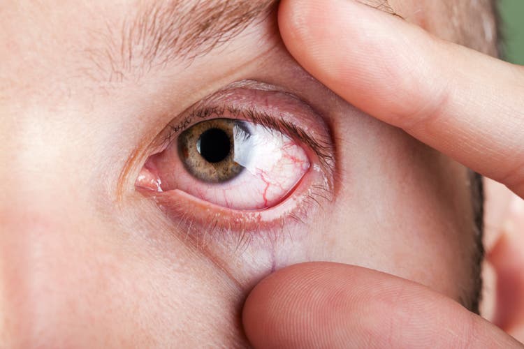 Blood capillary human eye