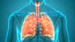 Insmed sees brensocatib NDA for bronchiectasis in Q4 article thumbnail