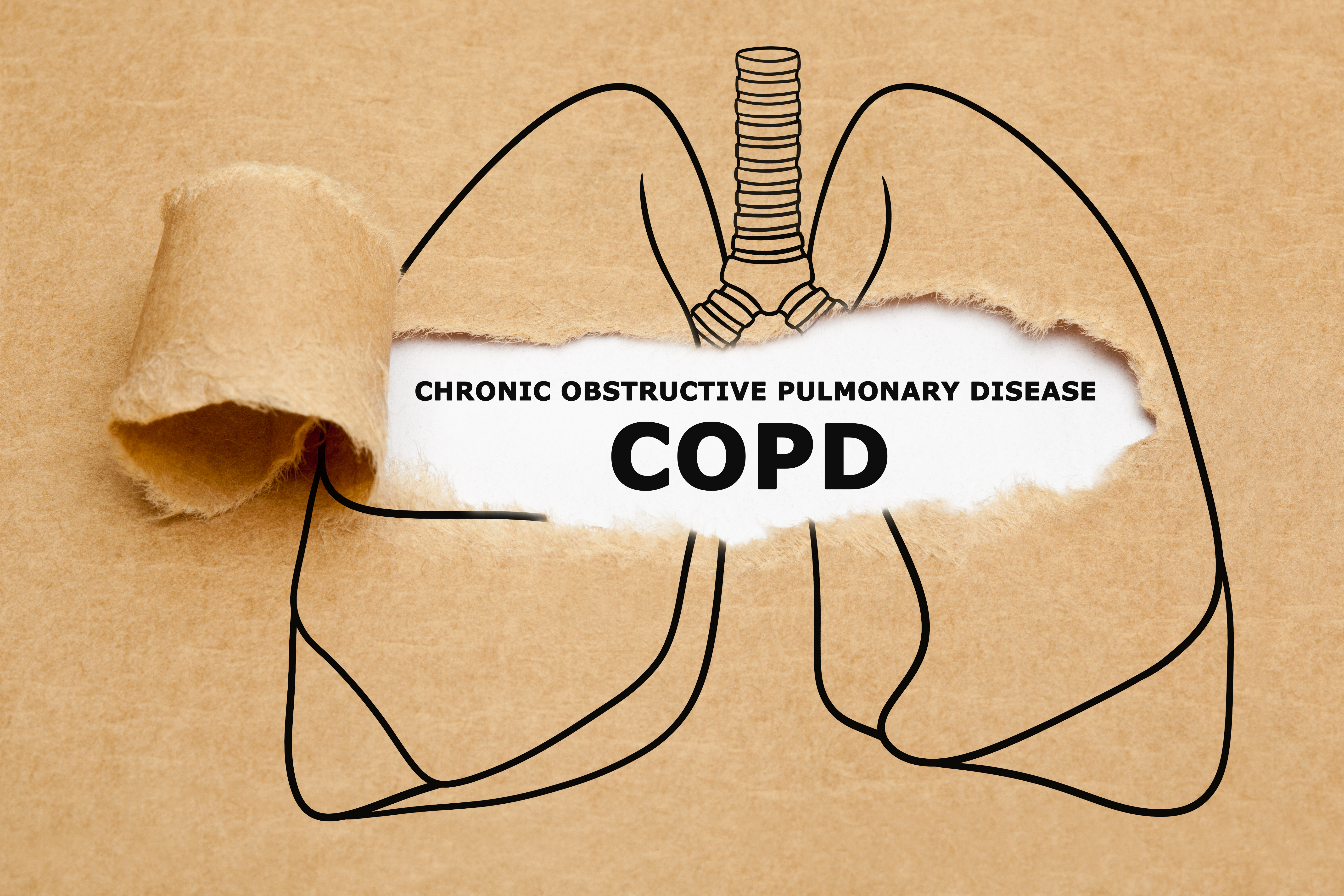 GSK Nucala Succeeds In Phase 3 COPD Trial (NYSE:GSK) | Seeking Alpha