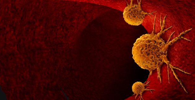 Cancer Anatomy