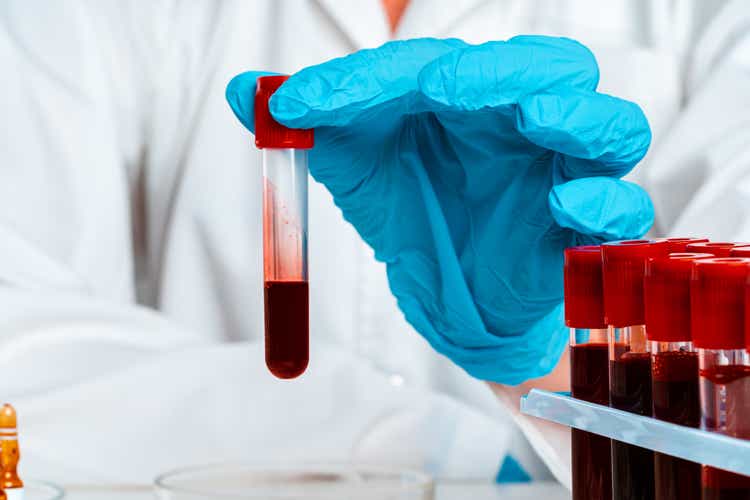 Doctor"s hands in blue gloves keep test tube with a blood