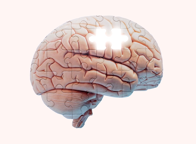 Brain puzzle missing a piece