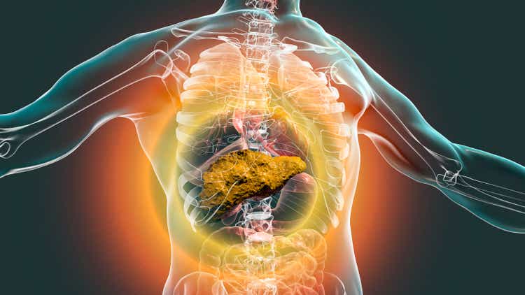 Liver with cirrhosis inside human body