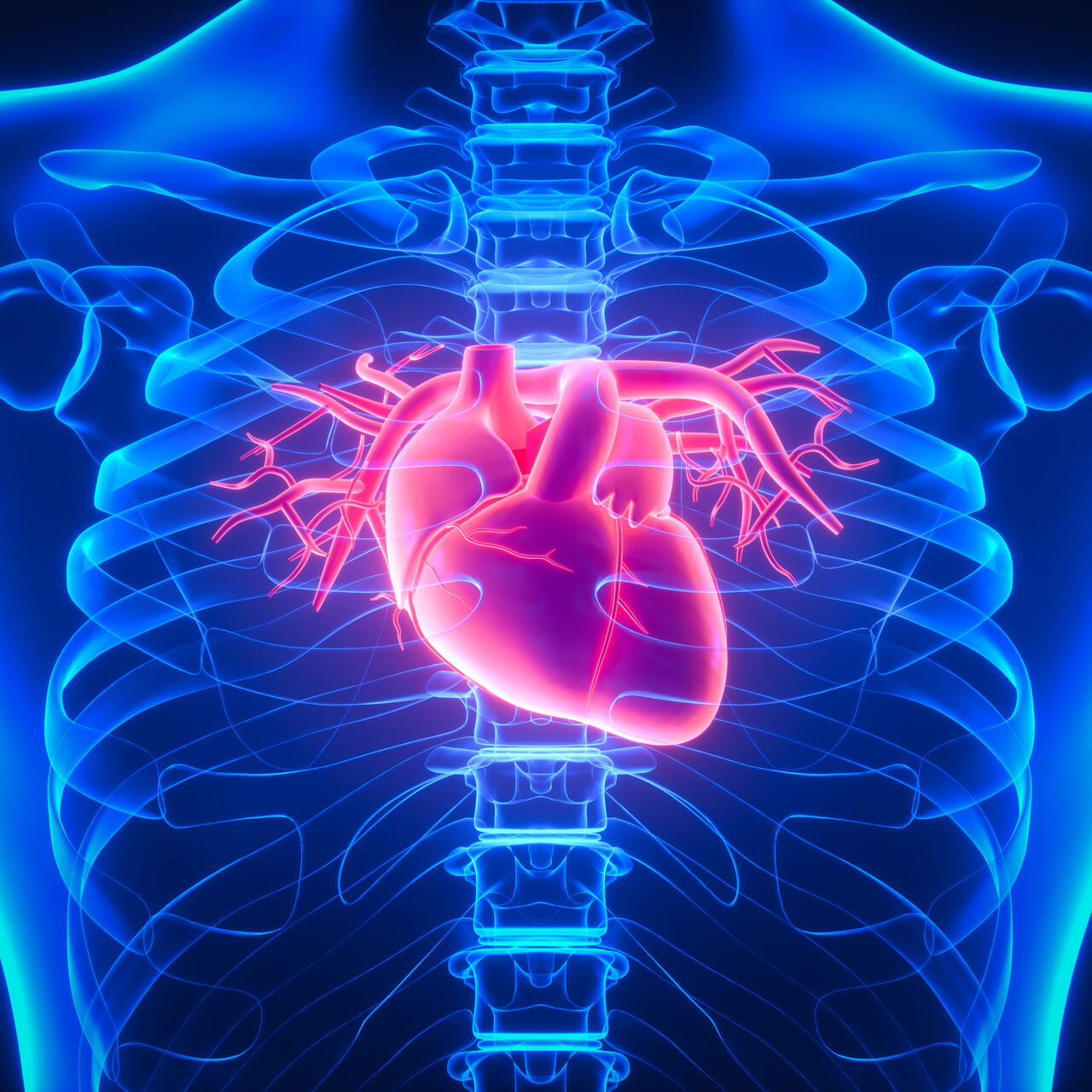 Abiomed preCARDIA system shows efficacy in heart failure patients ...