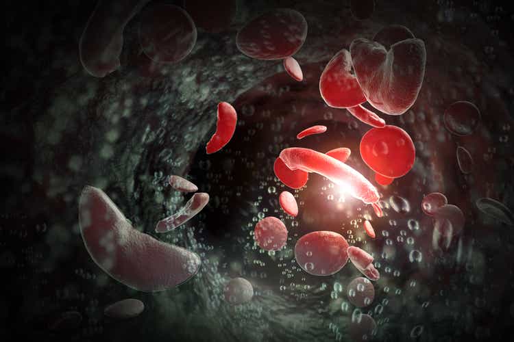 Sickle Cell Anemia 3D Illustration