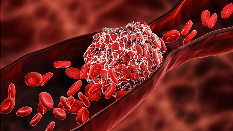 AngioDynamics: Focusing On Three Credible Growth Drivers And Targeting Growth Acceleration