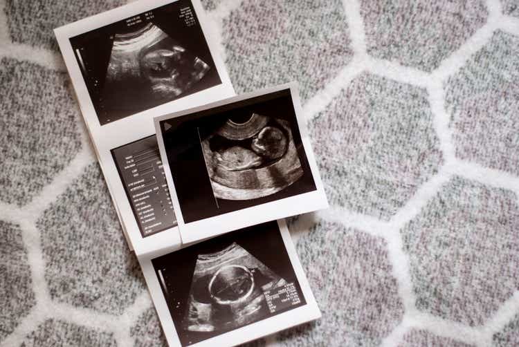 Waiting a baby: ultrasound results in the second trimester of pregnancy.