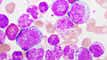 Terns Pharmaceuticals releases promising phase 1 data on leukemia candidate article thumbnail