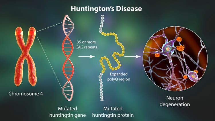 Molecular genesis of Huntington"s disease, 3D illustration