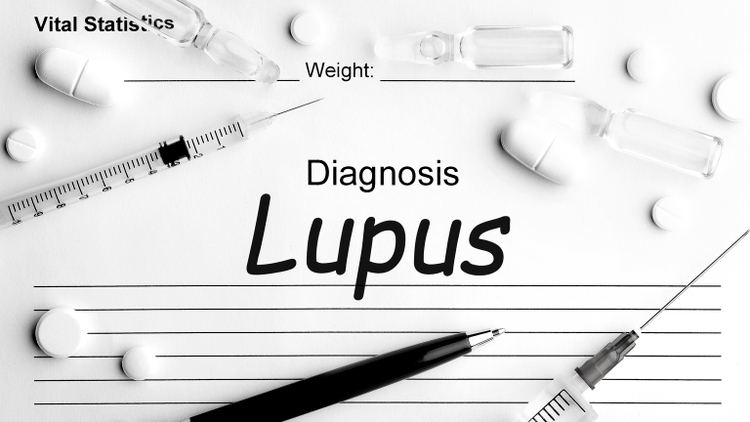 Word LUPUS on paper with pen, syringe and assorted pharmaceutical medicine pills, tablets and capsules