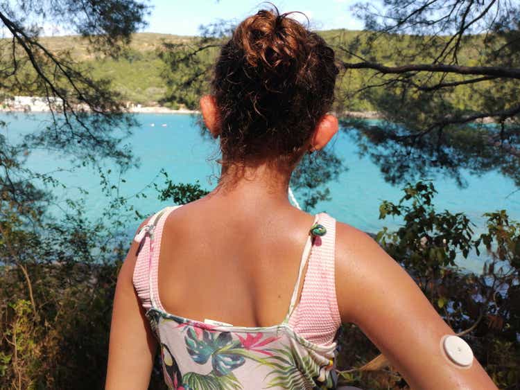 Girl with diabetes looks at the bay, beautiful turquoise sea and beach. On right arm is placed white sensor for continuous glucose monitoring – CGM. Control of glucose level in summertime, travel and vacation.