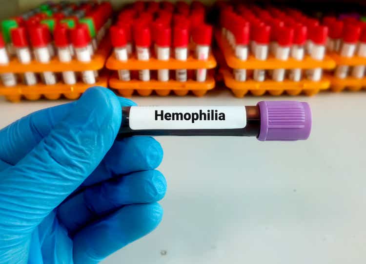 Blood sample for hemophilia test, inherited genetic disorder