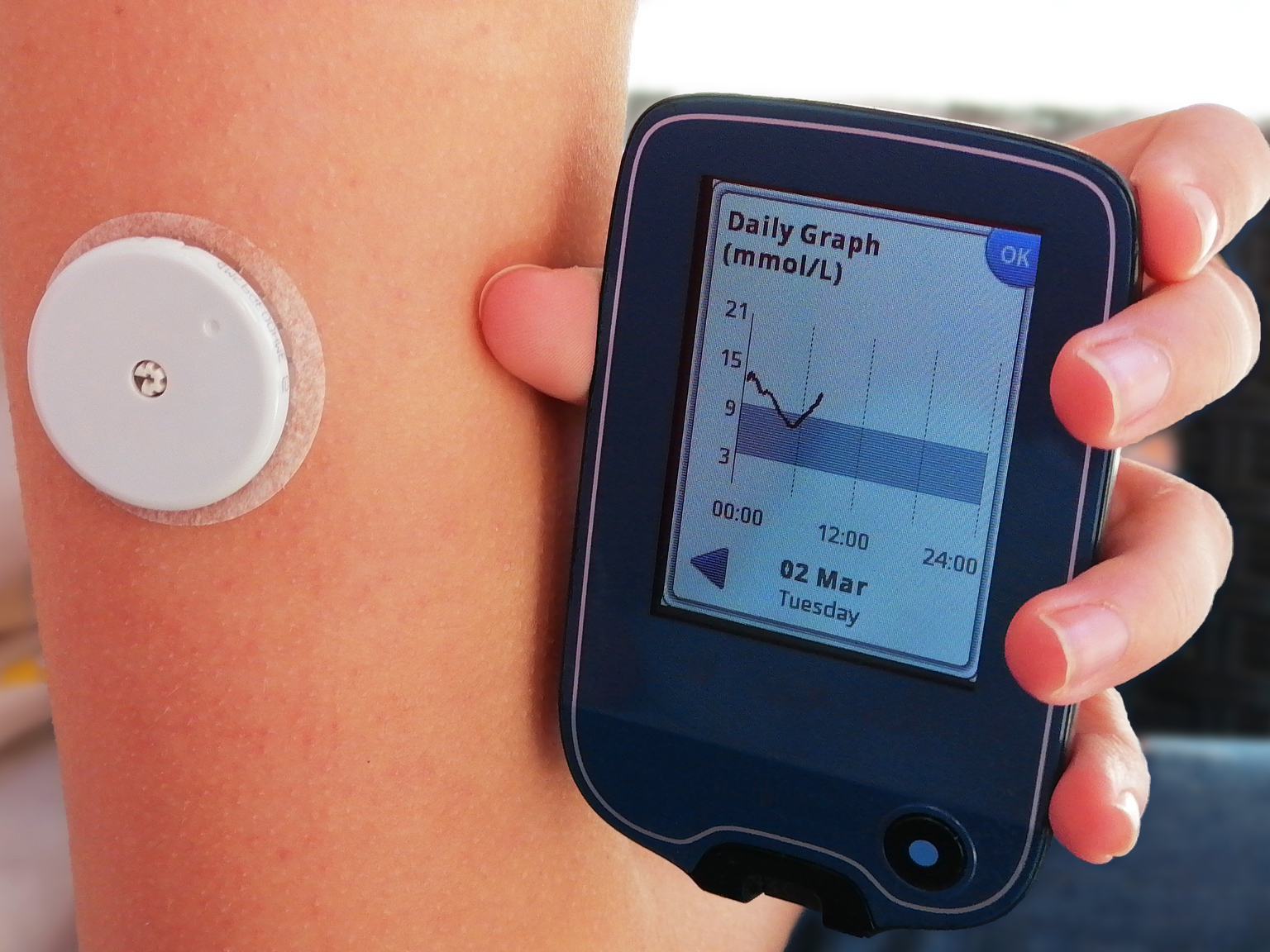 dexcom medical device