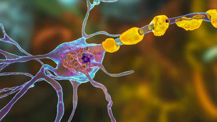 Brain neurons in lysosomal storage diseases, 3D illustration