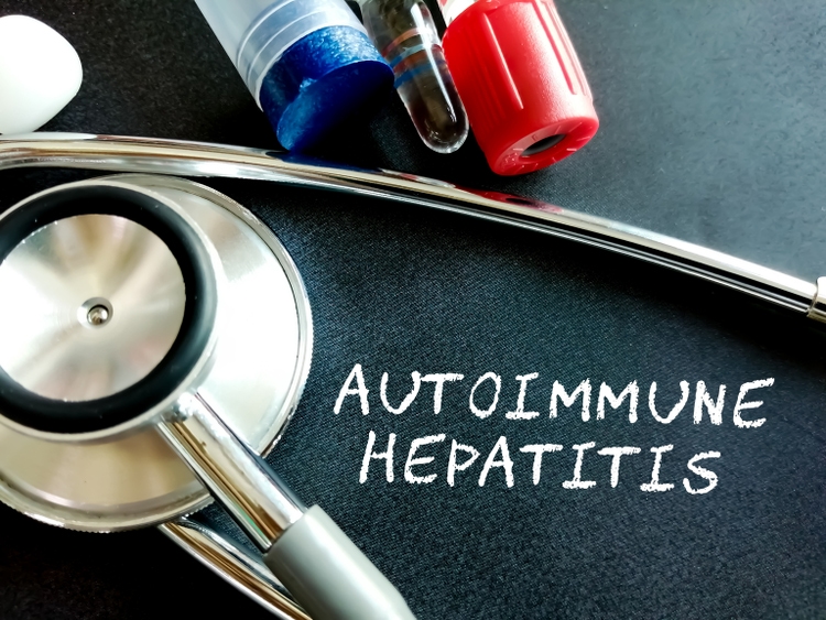 FDA Clears Kezar Life Sciences Drug Application For Autoimmune fda-clears-kezar-life-sciences-drug-application-for-autoimmune