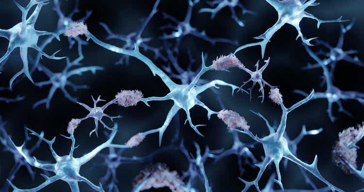 Alzheimer"s disease