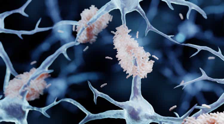 Amyloid plaques in Alzheimer"s disease