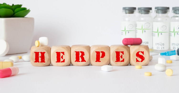 Herpes - word from wooden blocks with letters, viral diseases herpes viruses concept, blue background