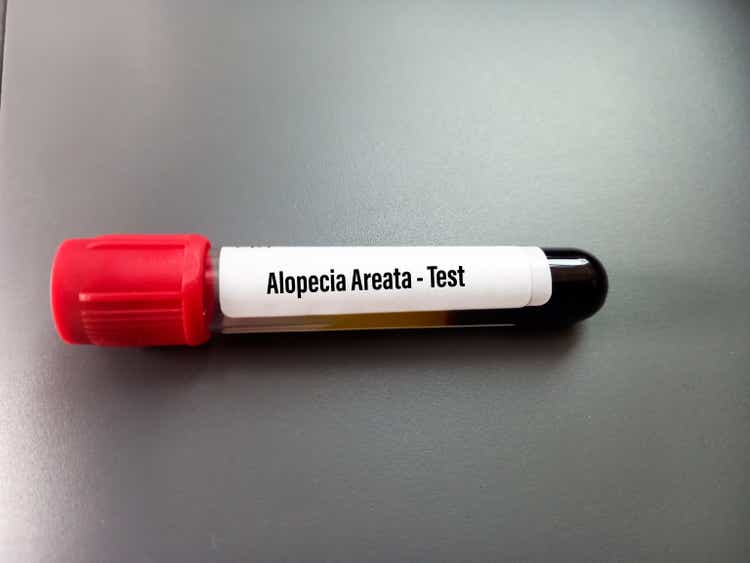 Blood sample for Alopecia Areata testing. A bald head in a person. Diffuse alopecia. Androgenic alopecia. Hair loss. Bald spots on the head. Trichology