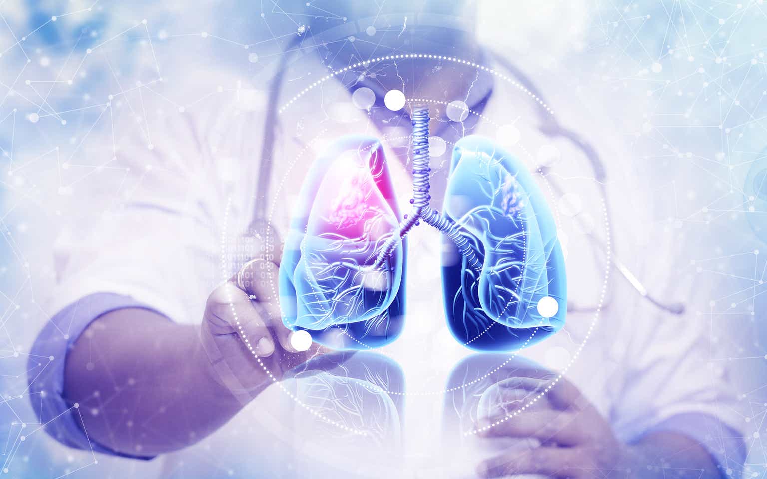 Verona Pharma: Breathing Deeply Could Bring Great Benefits (NASDAQ:VRNA ...