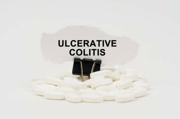 On a white surface are pills and torn paper with the inscription - ULCERATIVE COLITIS