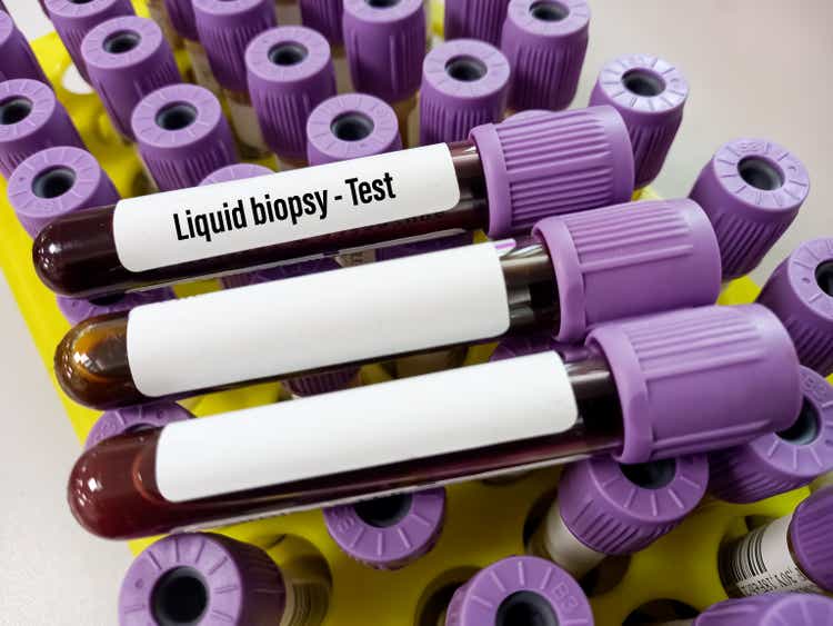 Blood samples for Liquid biopsy blood test to detect cancer cells