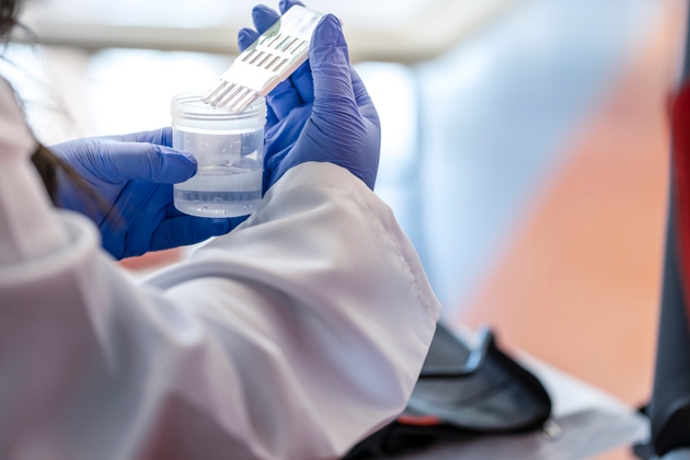 medical test
