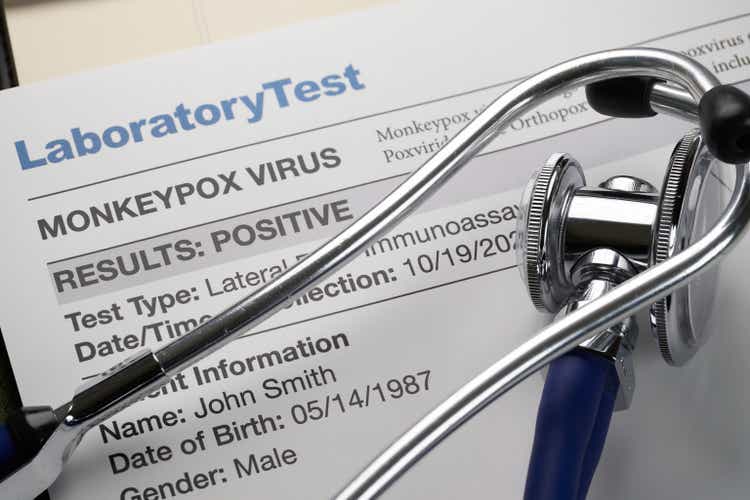 Monkeypox virus test results document with stethoscope