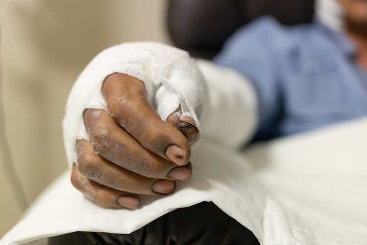 Patient with burns in the hospital