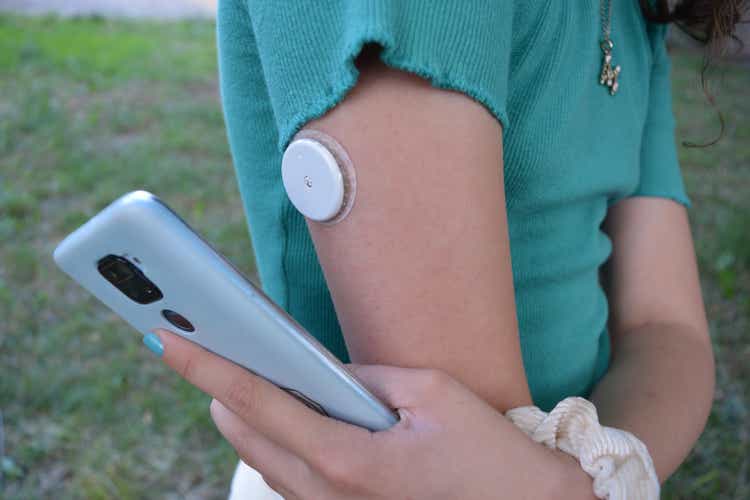 Girl with diabetes is reading the glucose levels from a white sensor on arm using mobile phone application. Modern technology in Medicine. Diabetes type 1. Insulin depend