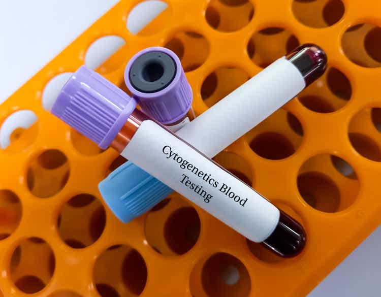 Blood sample for Cytogenetics blood testing to chromosomal analysis of blood for specific gene mutations in certain leukaemias. DNA analysis, chromosomal testing.