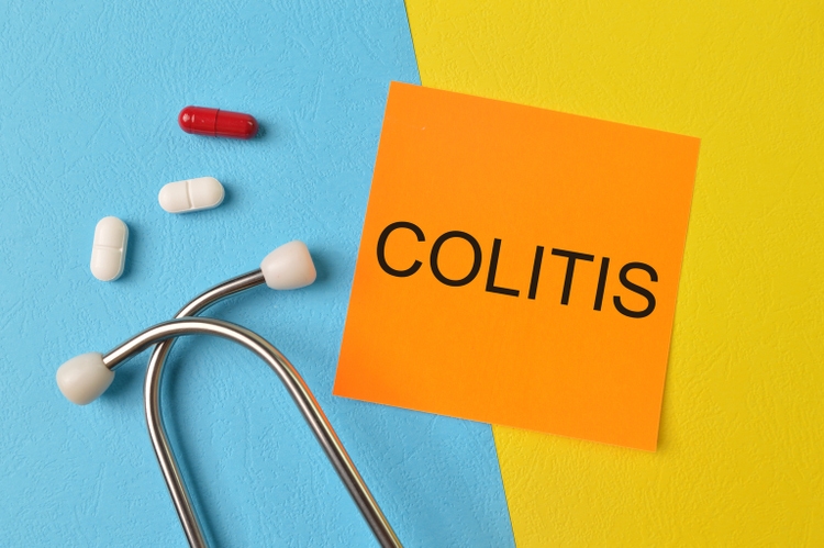 Morphic stock jumps as ulcerative colitis drug meets key goal | Seeking ...