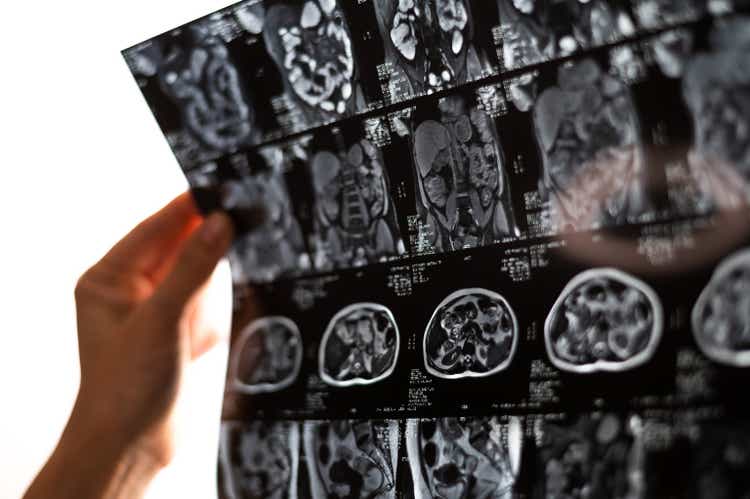 A female doctor examines an MRI scan of the internal organs. Abdomen.