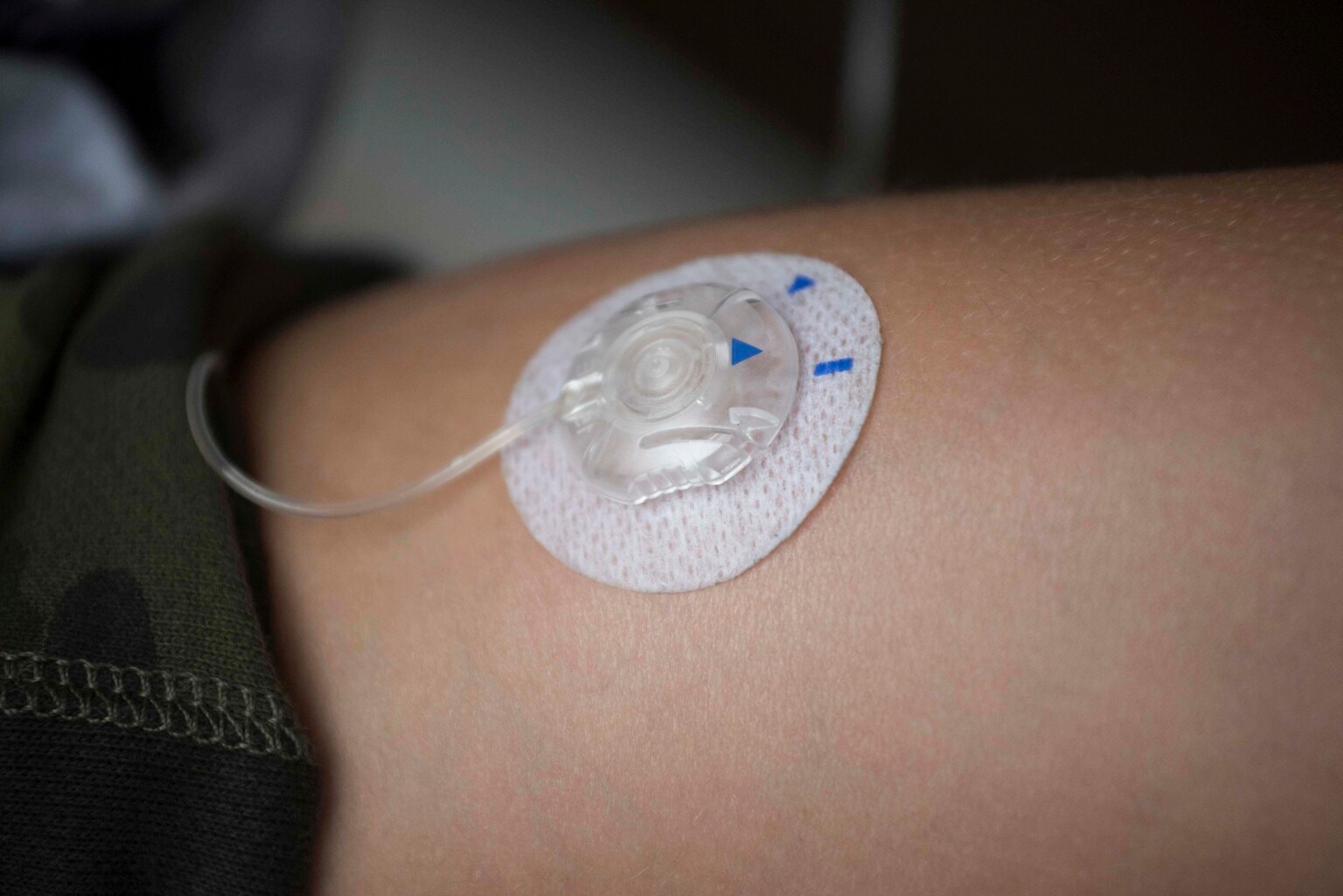 MiniMed Group Files For IPO In Medtronic Carve-Out (Pending:MMED)