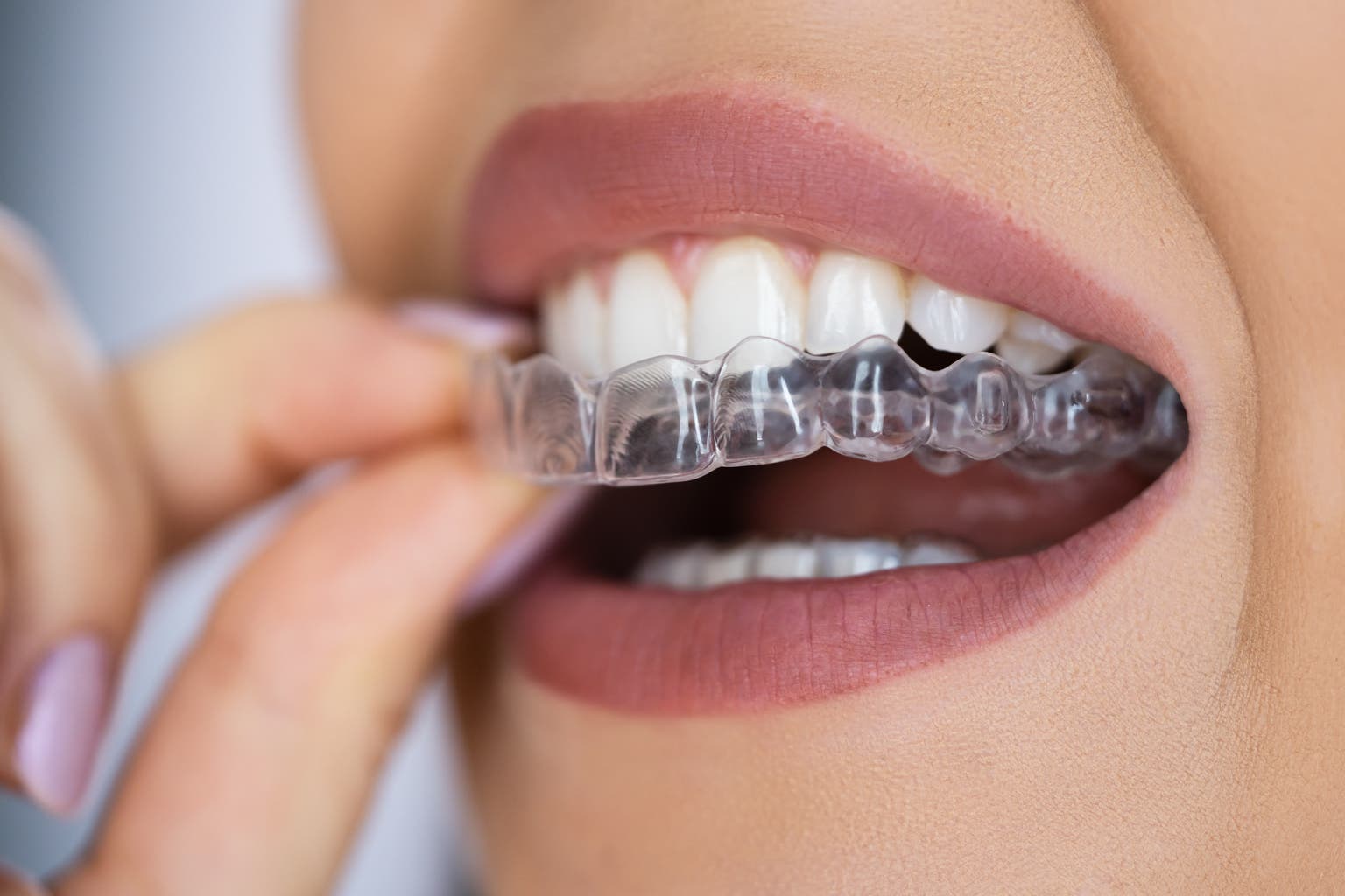 The Recessionistas Have Arrived, Need Proof? Tooth Have Gone Out Of Model