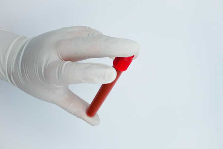 Blood tube for test detection of Virus. Test tube with red liquid in his hand. Medical workers hand. Medicine analyzes.