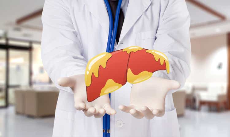 doctor touch fatty on liver , concept fatty liver