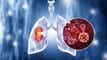 Johnson & Johnson receives Canadian approval for Rybrevant in first-line NSCLC article thumbnail