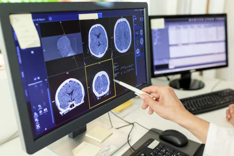 Close-up of woman doctor looking at CT scan report on computer monitor