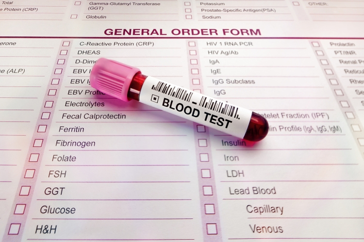 Blood test tube and form with list of analysis tests in medical laboratory