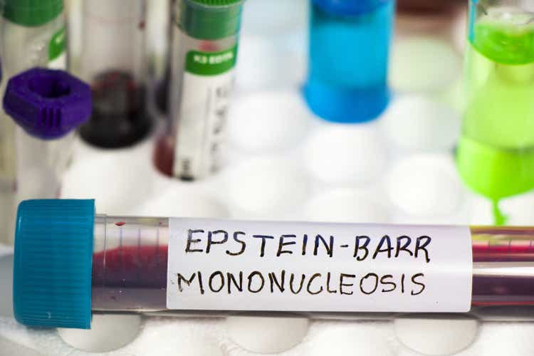Closeup of an EPSTEIN-BARR virus test tube on the table in the laboratory